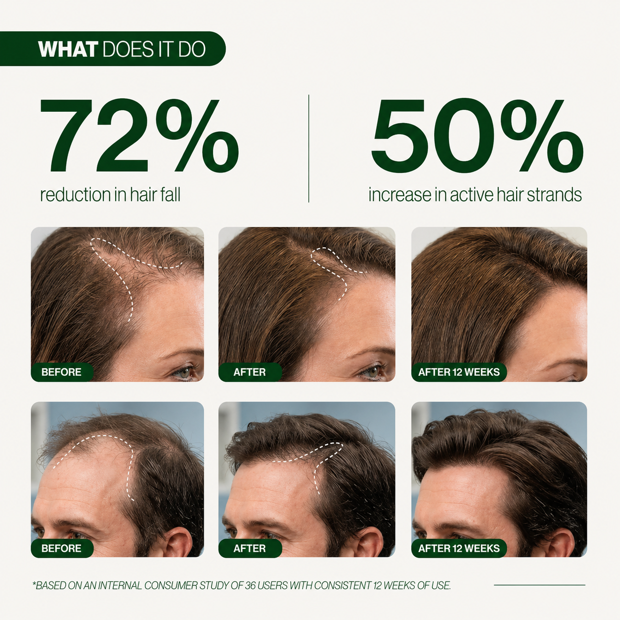 Hair Growth Serum Roll On