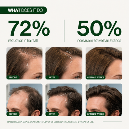 Hair Growth Serum Roll On